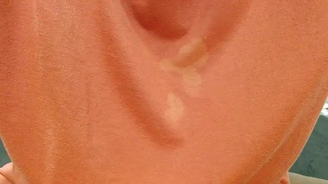 Cholatin online show from 10/07/25, 03:42